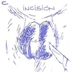 Inmunocastración en cerdos - Image 6