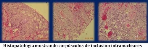 Laringotraqueitis Aviar - Image 10