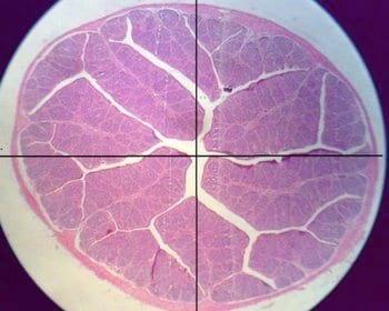 Experiencias practicas en el diagnostico de la infección de la Bolsa de Fabricio - Image 4
