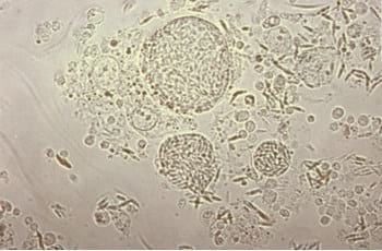 Coccidiosis: coccidiostatos o vacunas? - Image 5