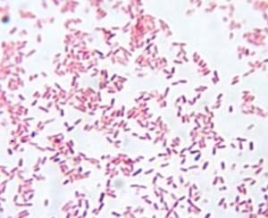 Bacteriologia en el complejo respiratorio de las aves - Image 2