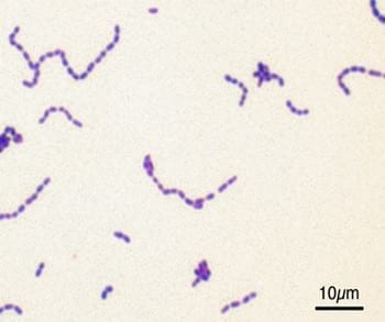 Bacteriologia en el complejo respiratorio de las aves - Image 6