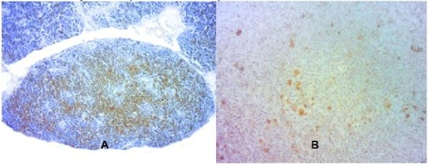 Efecto de la ventana de nacimiento en la planta de incubación sobre la presencia de células cd3 positivas en el sistema linfoide de pollos de engorde procedentes de huevos de diferentes pesos, de reproductoras de la misma edad - Image 1