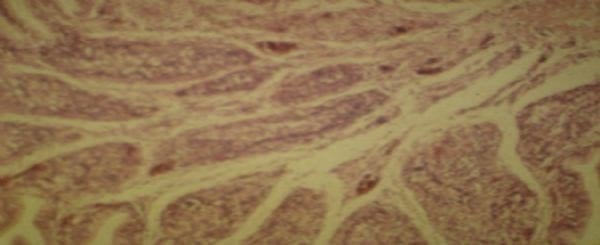 Diagnóstico de Salpingitis en hembras de pollos de engorde con mitocoxicosis - Image 3