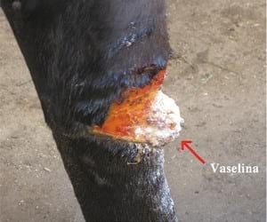 Manejo de tejido de granulación (queloide) en heridas de finasangre de carrera - Image 4