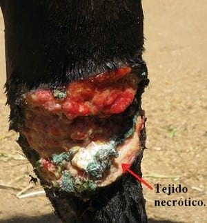 Manejo de tejido de granulación (queloide) en heridas de finasangre de carrera - Image 1