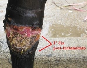 Manejo de tejido de granulación (queloide) en heridas de finasangre de carrera - Image 5