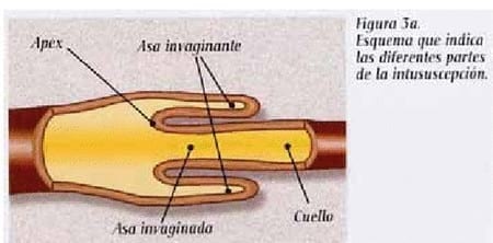 Intususcepción neonatal bovina - Image 1