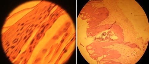 Paraqueratosis en Cerdos por deficit de Zinc - Image 4