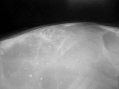 Neoplasia de Cráneo en Potranca, Hallazgo Clínico - Image 7