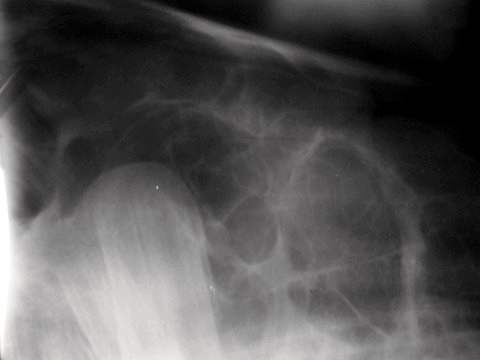 Neoplasia de Cráneo en Potranca, Hallazgo Clínico - Image 5