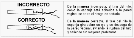 Consejos y datos para la sincronización de estro en lanares con esponjas intravaginales - Image 1