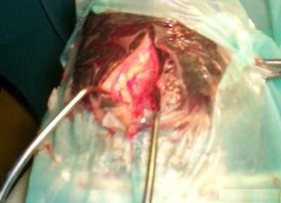 Fractura Proceso Extensor de la tercera falange en equinos - Image 5