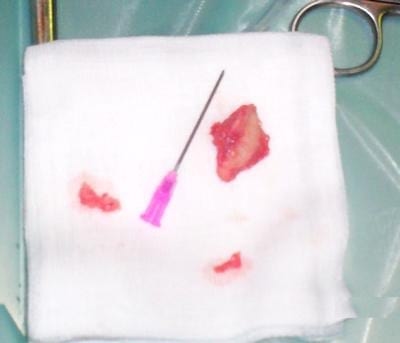 Fractura Proceso Extensor de la tercera falange en equinos - Image 6