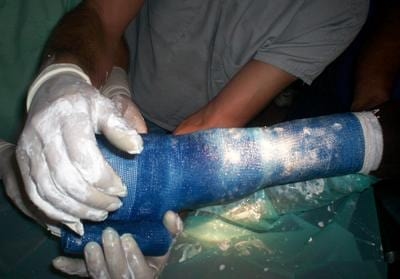 Fractura Proceso Extensor de la tercera falange en equinos - Image 8