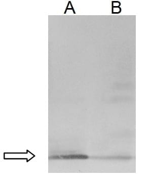 Anticuerpos de yema de huevo para la neutralización de la toxina Shiga - Image 1
