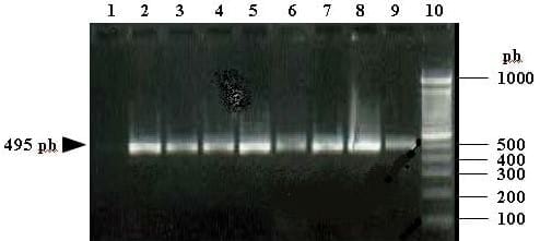 Estudios de contaminación con aflatoxinas producidas por Aspergillus flavus en la castaña y el maní - Image 3