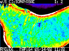 El uso de la termografía en equinos como herramienta complementaria de diagnóstico - Image 4