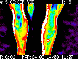 El uso de la termografía en equinos como herramienta complementaria de diagnóstico - Image 7