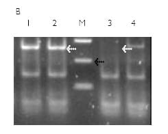 Utilización de Marcadores Moleculares en el Mejoramiento de Trigo - Genes de Calidad y Resistencia a Enfermedades - Image 2
