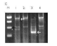 Utilización de Marcadores Moleculares en el Mejoramiento de Trigo - Genes de Calidad y Resistencia a Enfermedades - Image 3