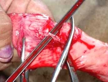 Ajuste de la técnica operatoria del corte del ligamento apical dorsal del pene en toros receladores o detectores de celo - Image 8
