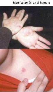 Dermatofitosis del conejo, micosis o tiña - Image 3