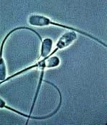 Conservación de la calidad del Semen: Diluyentes, Empaque, Temperatura y Transporte - Image 2