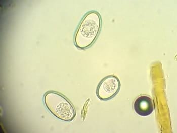 Enfermedades parasitarias gastrointestinales y pulmonares de bovinos, ovinos y caprinos - Image 10
