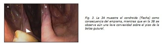 Informe Técnico: Adenitis Equina - Image 3