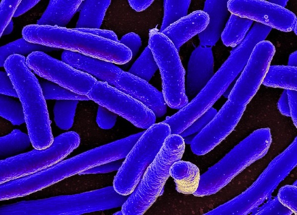 La resistencia a los antibióticos se puede transmitir de animales a personas - Image 1