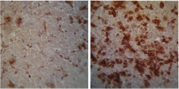 BRasil - Salmonella en aves: Formas mutantes la vuelven más agresiva - Image 1
