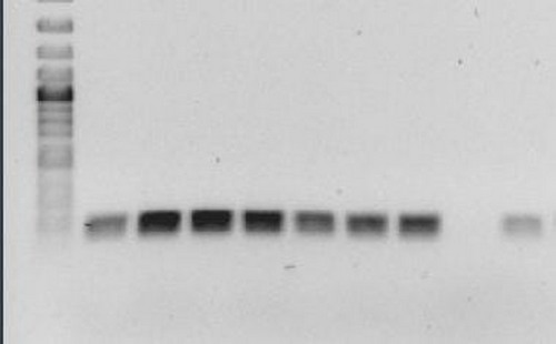 Colombia - Identifican grupos de virus de gripe porcina que mejorarán su diagnóstico - Image 3