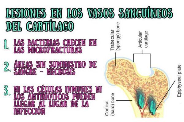 ¿Problemas de cojeras? Sus aves podrían sufrir el “síndrome del intestino permeable» - Image 4