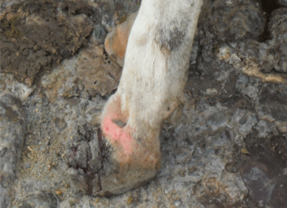 Dermatitis verrucosa y flemón coronario.