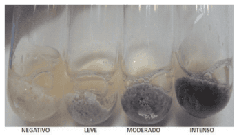 Diagnóstico de cetosis subclínica y balance energético negativo en vacas lecheras mediante el uso de muestras de sangre, orina y leche - Image 1