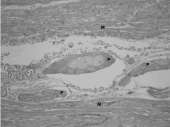 Caso clínico: Brote de enfermedad del músculo blanco o miodegeneración nutricional en terneros - Image 4
