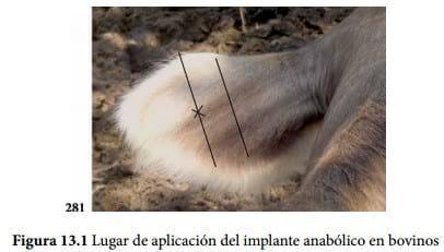 Implantes - Image 1