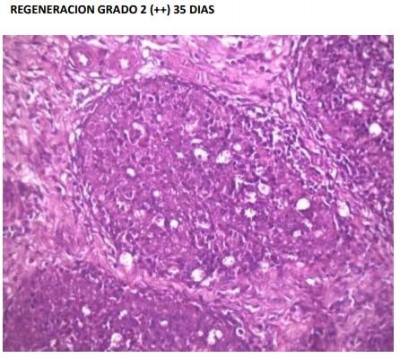 Evaluación diagnostica de situaciones clínicas de inmunosupresión en pollos de engorde: Hepatitis por Cuerpos de Inclusión y posibles enfermedades coadyuvantes - Image 6