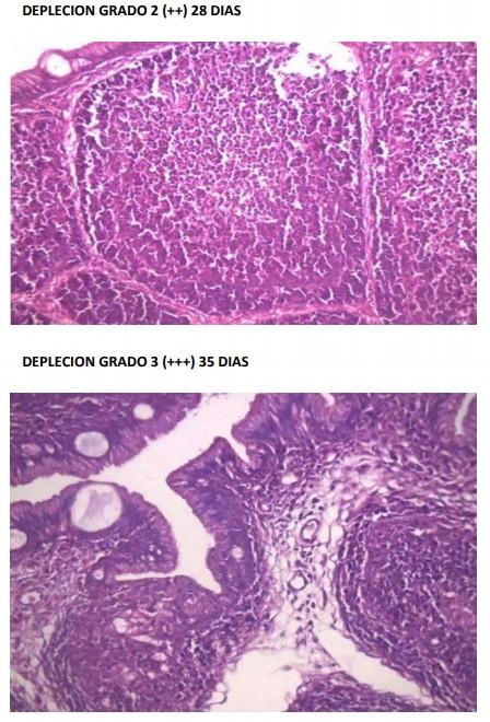 Evaluación diagnostica de situaciones clínicas de inmunosupresión en pollos de engorde: Hepatitis por Cuerpos de Inclusión y posibles enfermedades coadyuvantes - Image 5