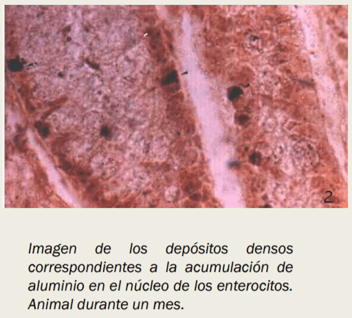 Intoxicación por plomo - Image 13
