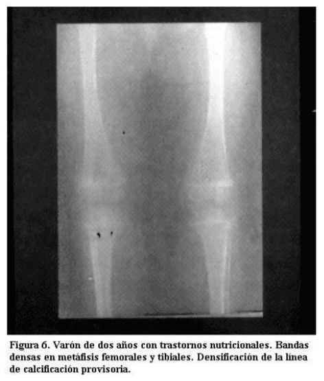 Intoxicación por plomo - Image 11