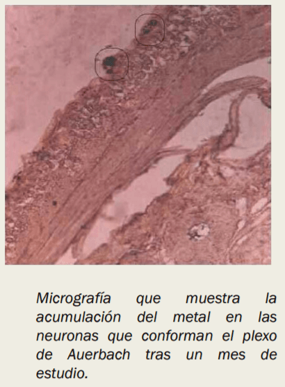 Intoxicación por plomo - Image 14