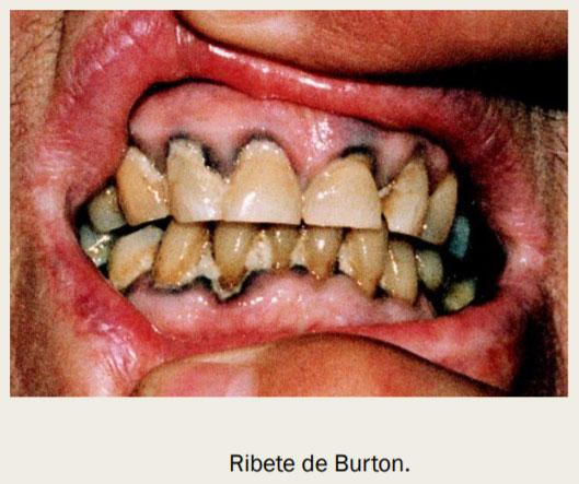 Intoxicación por plomo - Image 16
