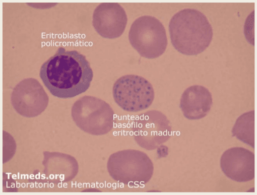 Intoxicación por plomo - Image 10