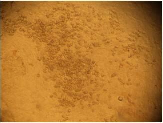 La importancia del monitoreo de la coccidiosis - Image 6