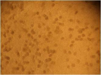 La importancia del monitoreo de la coccidiosis - Image 7