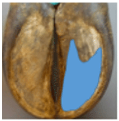 Conoce la pezuña de tu vaca | Engormix