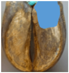 Figura 4. Bulbo o talón de la pezuña. Fuente Propia