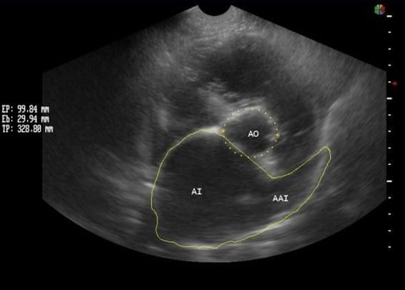 Caso Clínico: Cardiomiopatia Dilatada Canina Con Fibrilacion Atrial - Image 3